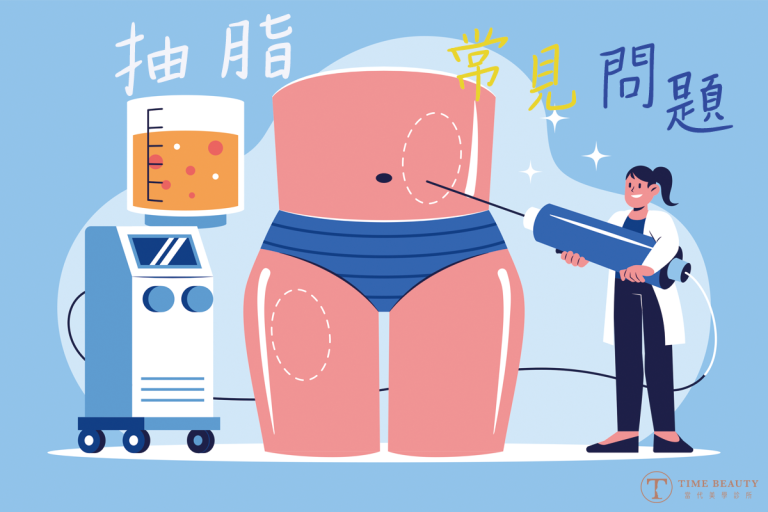 威塑抽脂