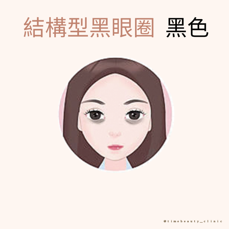 眼袋淚溝 - 當代美學診所 Time Beauty - 當代美學診所 Time Beauty 眼袋淚溝
