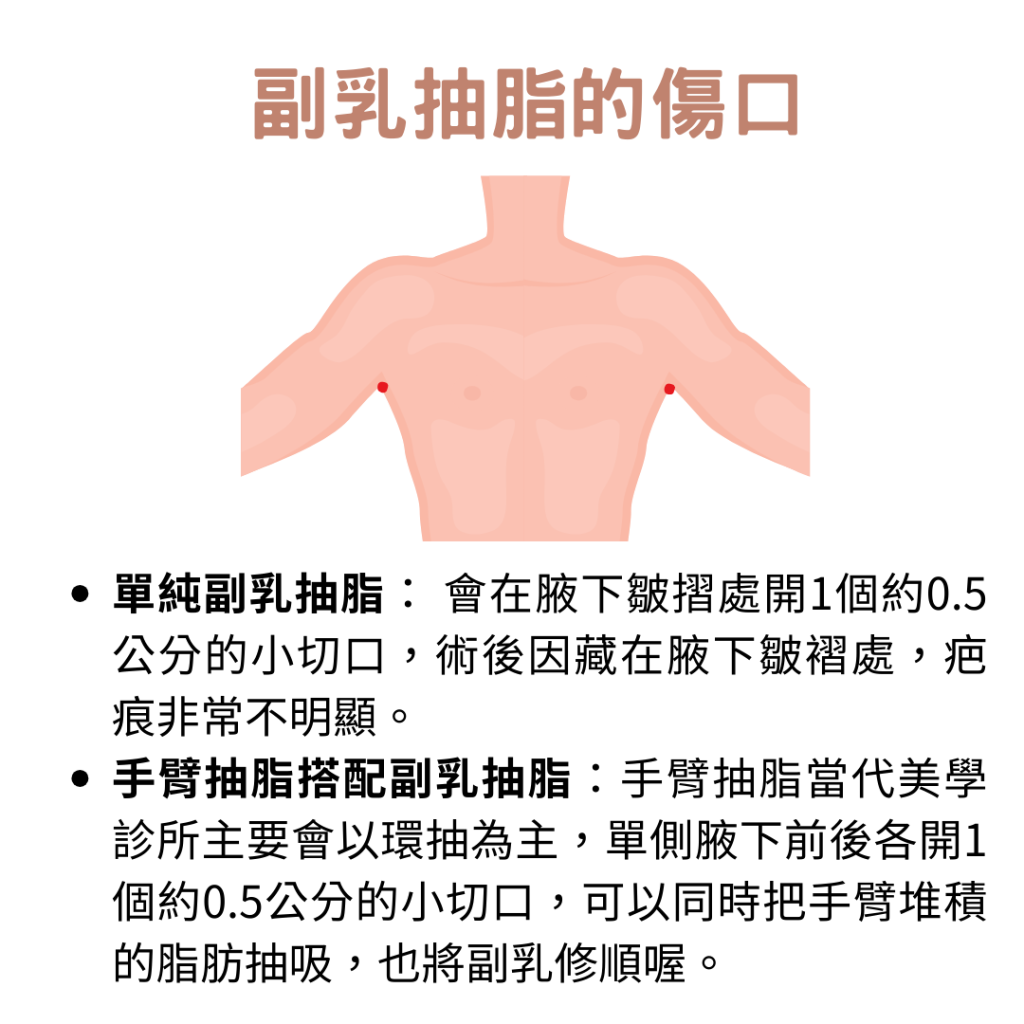 抽脂傷口