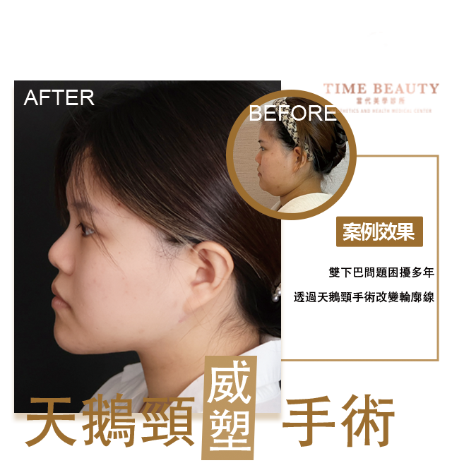 柯雯鏸20251016