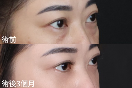 張郁雯20261223