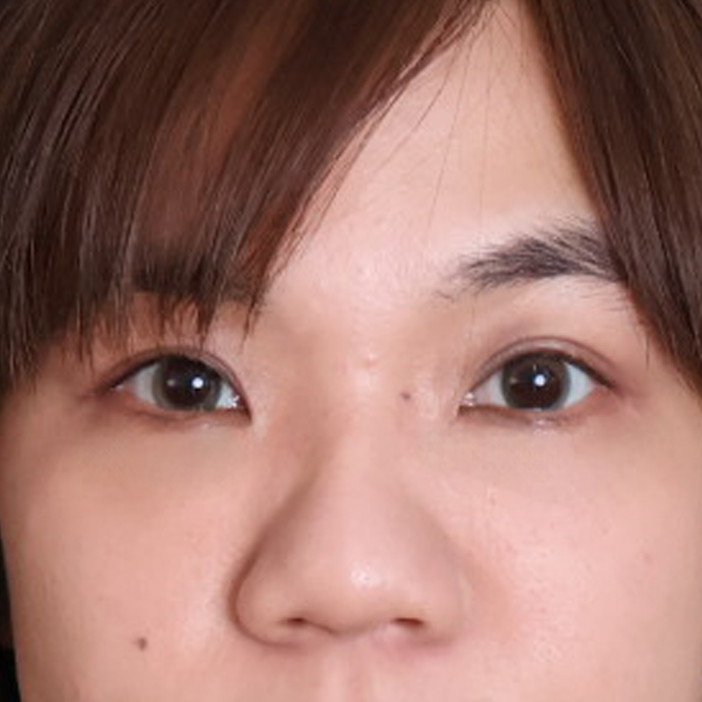 After