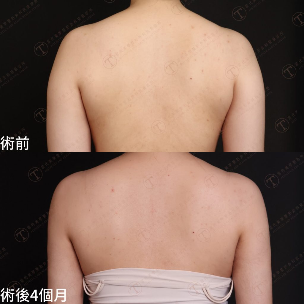 謝佳2 拷貝