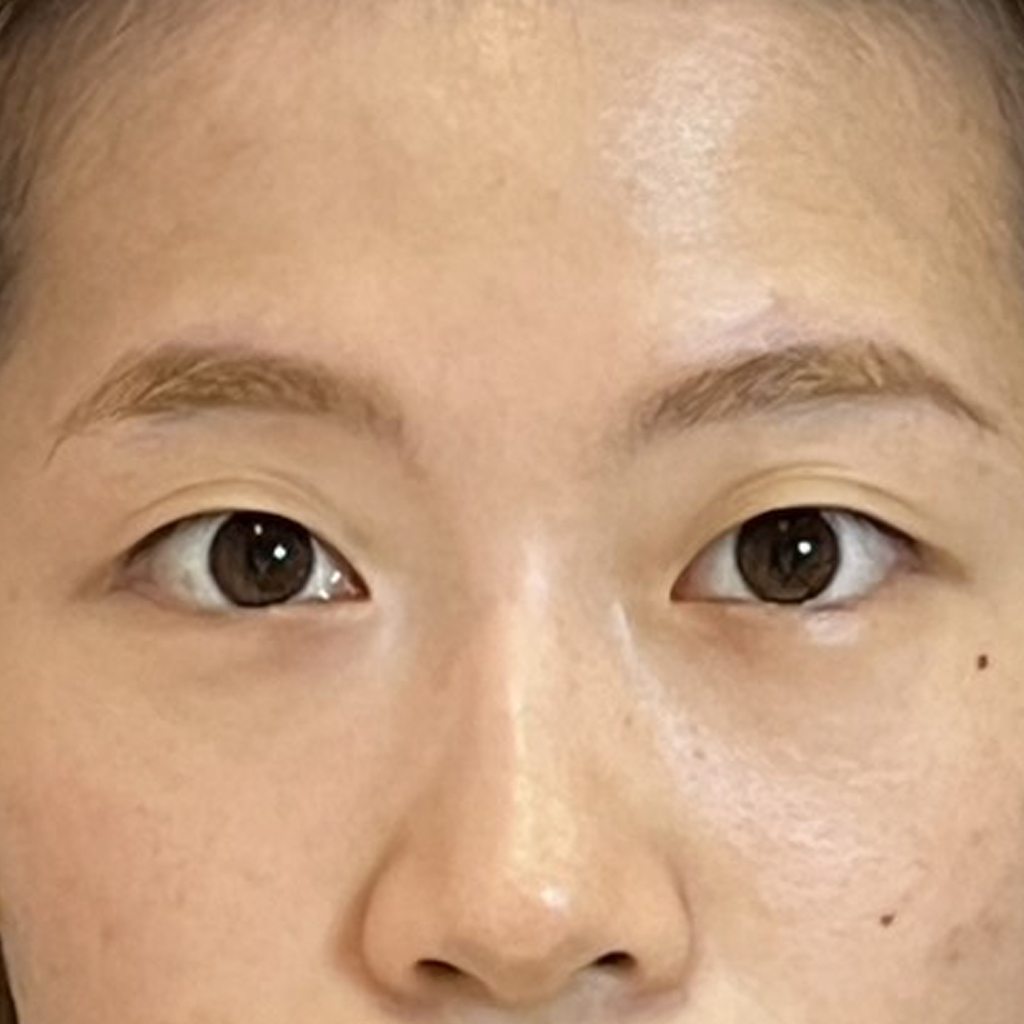 Before
