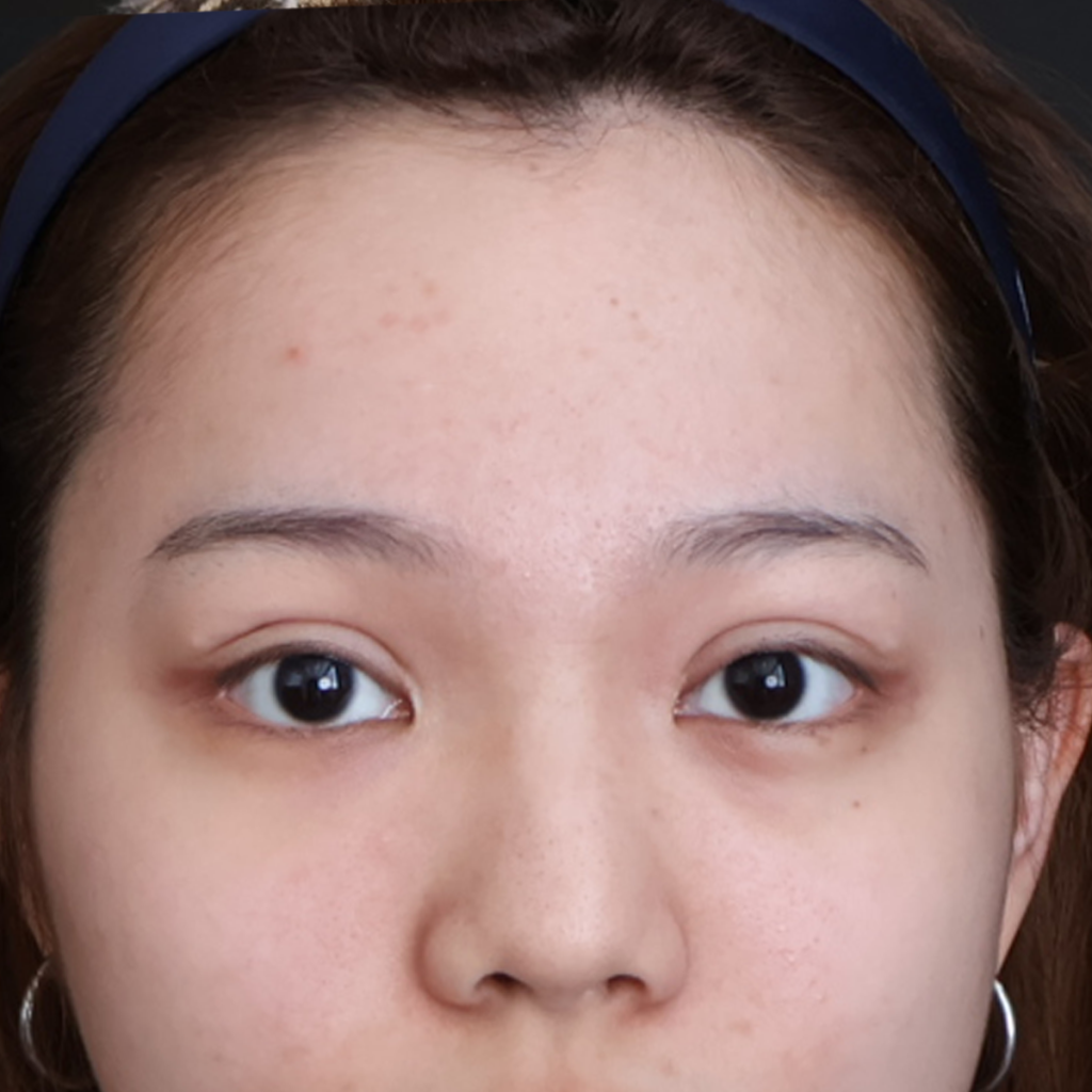 After