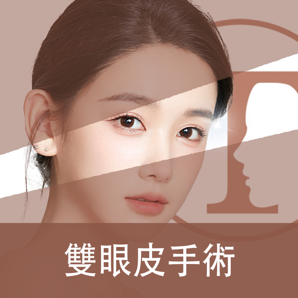 雙眼皮手術