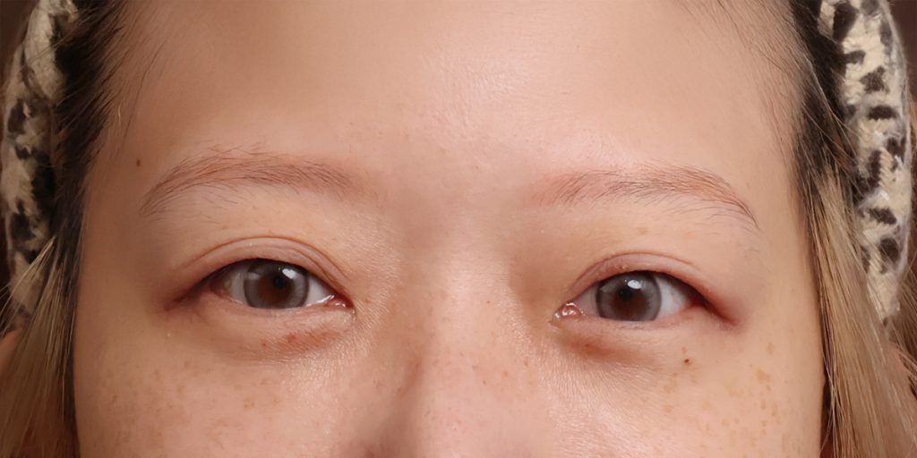 After