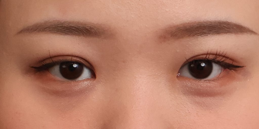 After